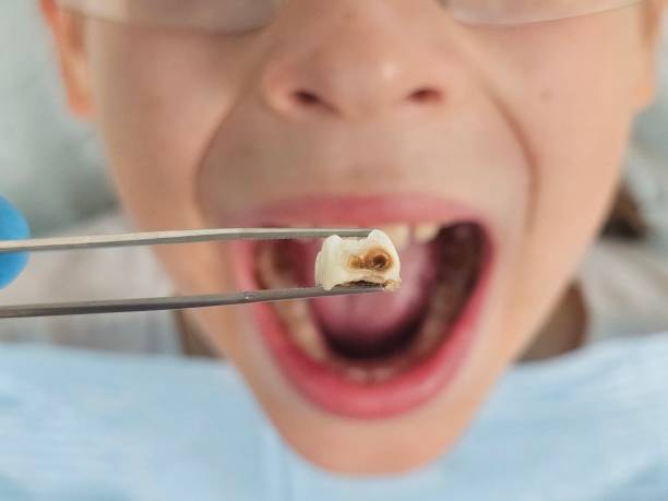 Best Emergency Care for Gum Disease in Newaygo, MI